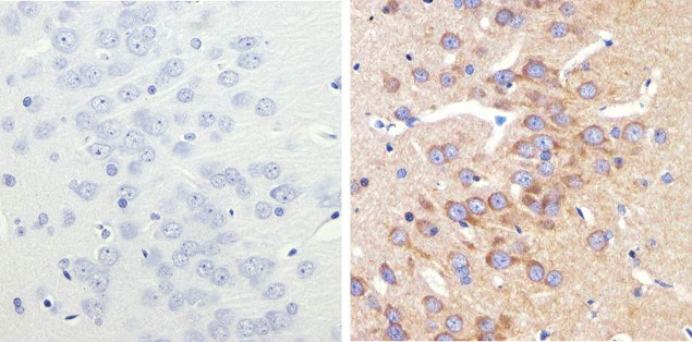 LC3B Antibody in Immunohistochemistry (Paraffin) (IHC (P))