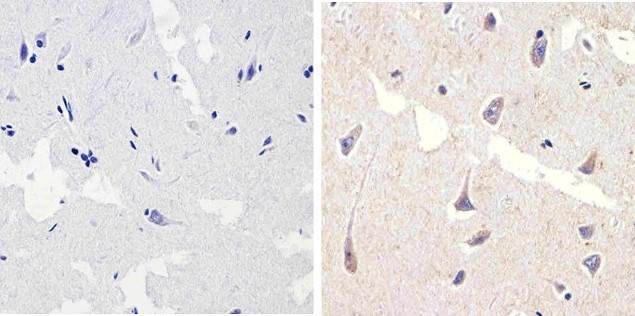 Phospho-p38 MAPK (Thr180, Tyr182) Antibody in Immunohistochemistry (Paraffin) (IHC (P))