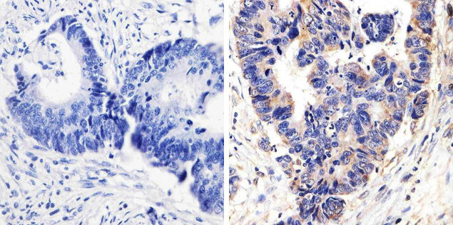 Phospho-p38 MAPK (Thr180, Tyr182) Antibody in Immunohistochemistry (Paraffin) (IHC (P))