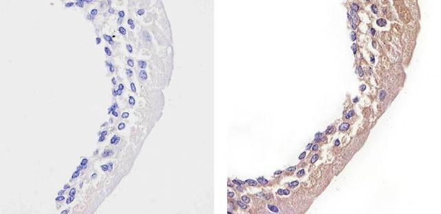 STAT2 Antibody in Immunohistochemistry (Paraffin) (IHC (P))