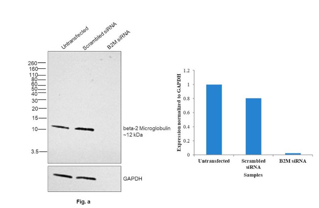 beta-2 Microglobulin Antibody