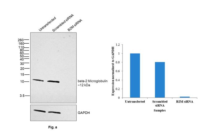 beta-2 Microglobulin Antibody in Western Blot (WB)