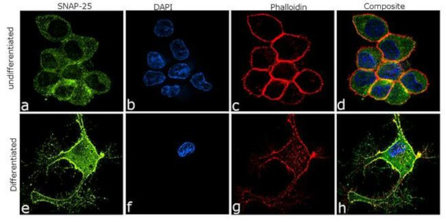 SNAP25 Antibody in Immunocytochemistry (ICC/IF)