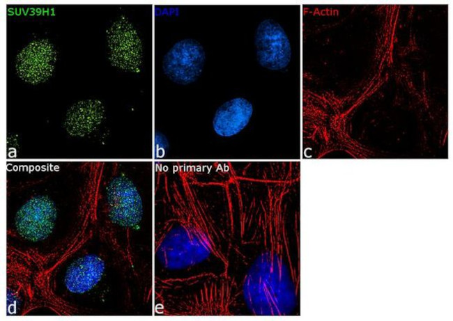 SUV39H1 Antibody in Immunocytochemistry (ICC/IF)