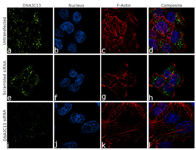 DNAJC13 Antibody in Immunocytochemistry (ICC/IF)