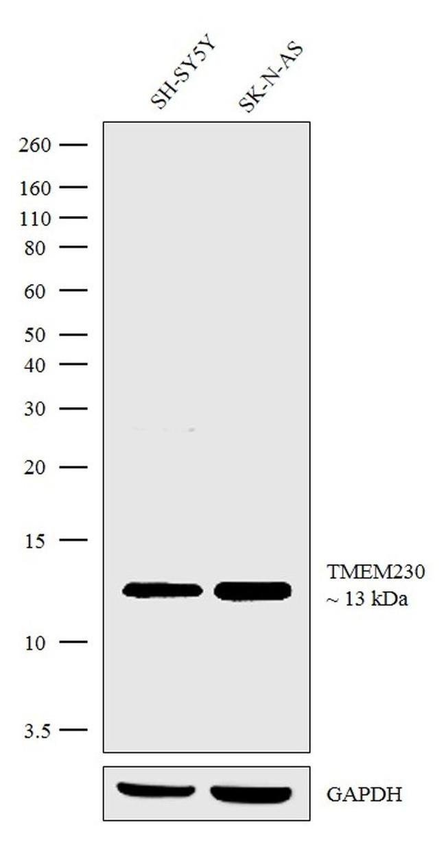 TMEM230 Antibody in Western Blot (WB)