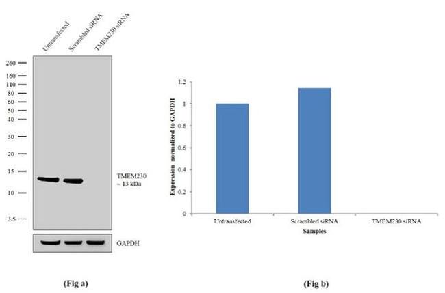 TMEM230 Antibody in Western Blot (WB)