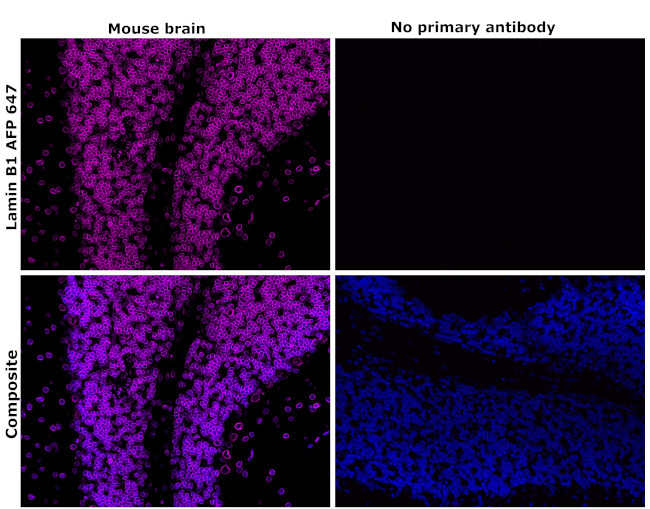 Lamin B1 Antibody in Immunohistochemistry (Paraffin) (IHC (P))