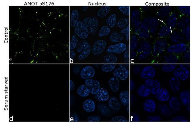 Phospho-AMOT (Ser175) Antibody