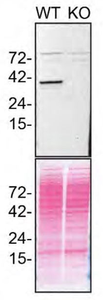 STING Antibody in Western Blot (WB)