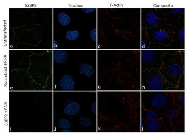 53BP2 Antibody in Immunocytochemistry (ICC/IF)