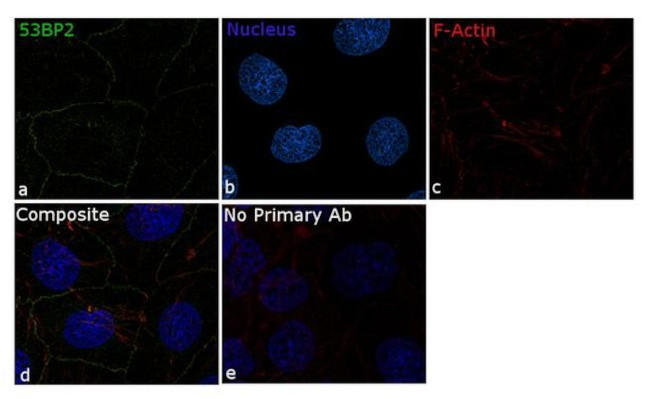 53BP2 Antibody in Immunocytochemistry (ICC/IF)