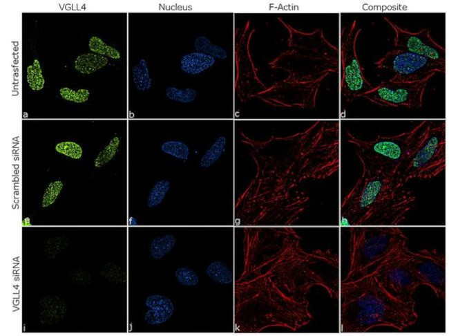 VGLL4 Antibody in Immunocytochemistry (ICC/IF)