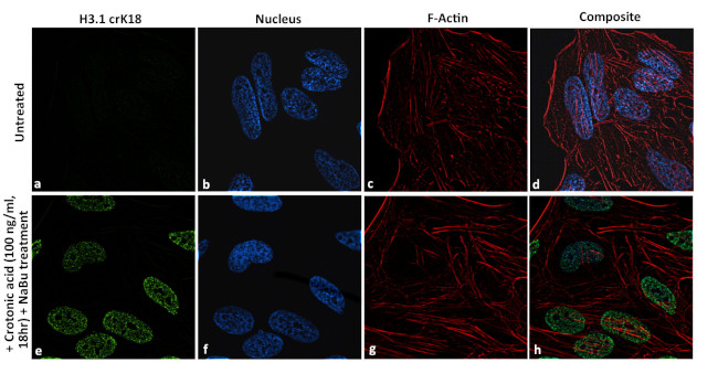 H3K18cr Antibody in Immunocytochemistry (ICC/IF)