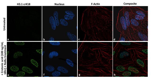 H3K18cr Antibody