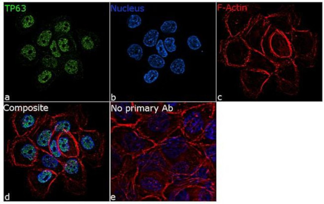 TP63 Antibody in Immunocytochemistry (ICC/IF)