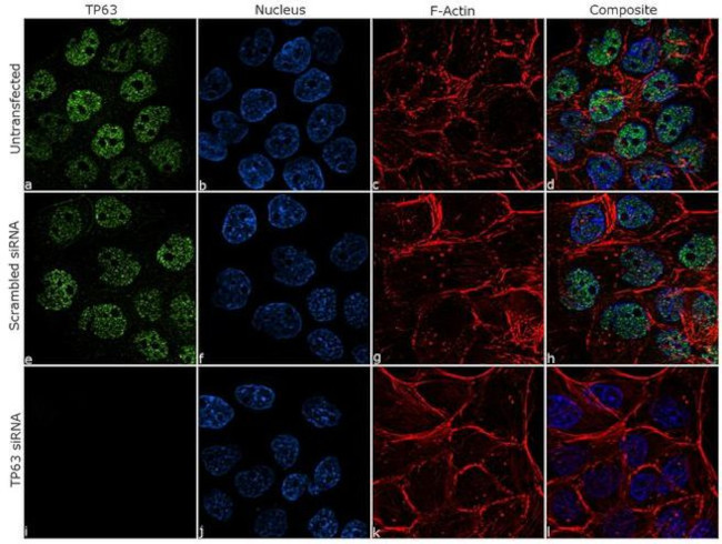 TP63 Antibody in Immunocytochemistry (ICC/IF)