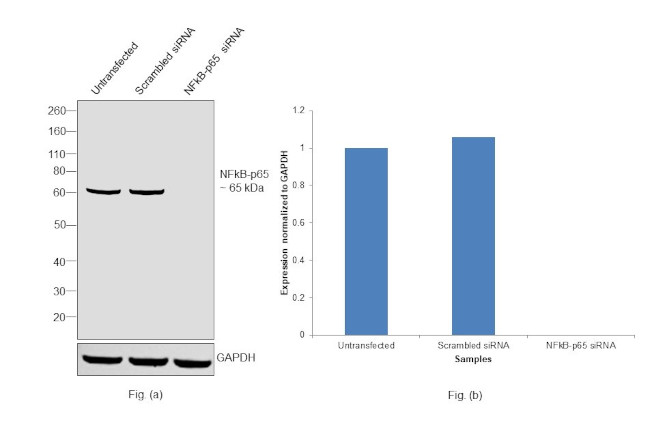 NFkB p65 Antibody