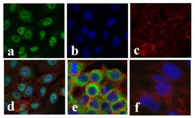 NFkB p65 Antibody