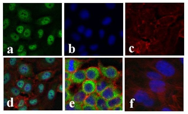 NFkB p65 Antibody in Immunocytochemistry (ICC/IF)