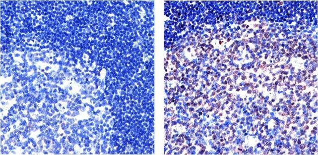 NFkB p65 Antibody in Immunohistochemistry (Paraffin) (IHC (P))