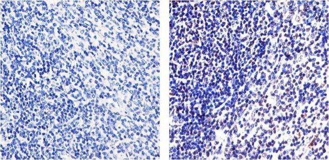 NFkB p65 Antibody in Immunohistochemistry (Paraffin) (IHC (P))