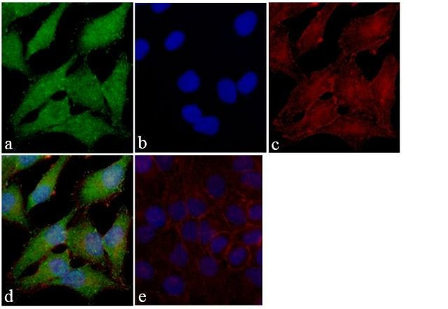 FAK Antibody in Immunocytochemistry (ICC/IF)