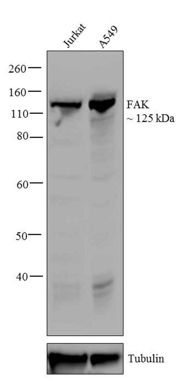 FAK Antibody in Western Blot (WB)