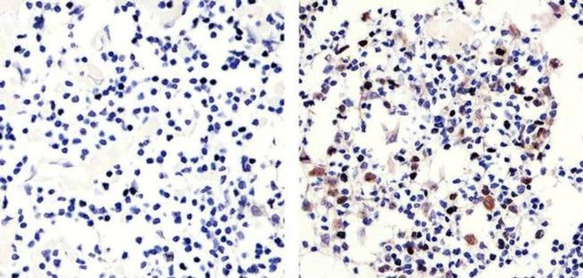 Phospho-Rb (Thr821) Antibody in Immunohistochemistry (Paraffin) (IHC (P))