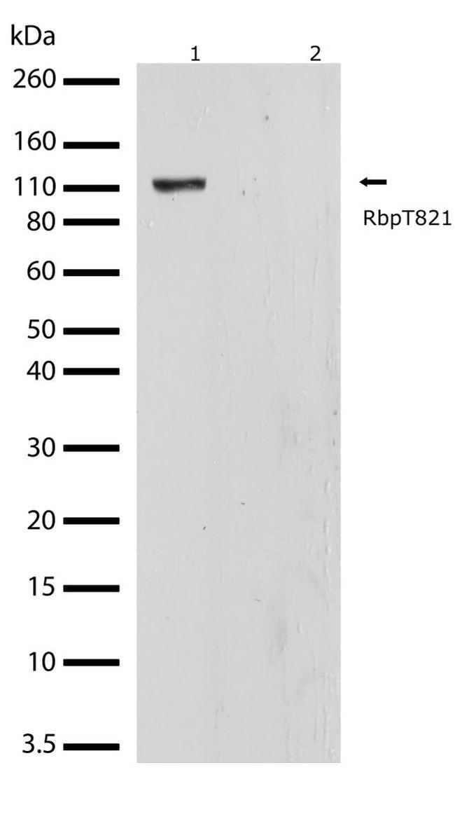 Phospho-Rb (Thr821) Antibody in Western Blot (WB)