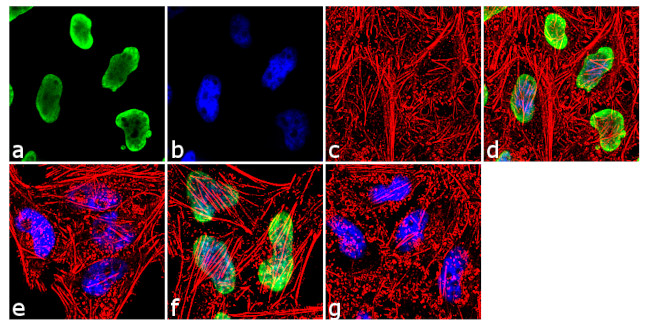 H3K9me2 Antibody in Immunocytochemistry (ICC/IF)