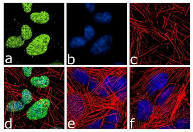 Neurogenin 2 Antibody in Immunocytochemistry (ICC/IF)