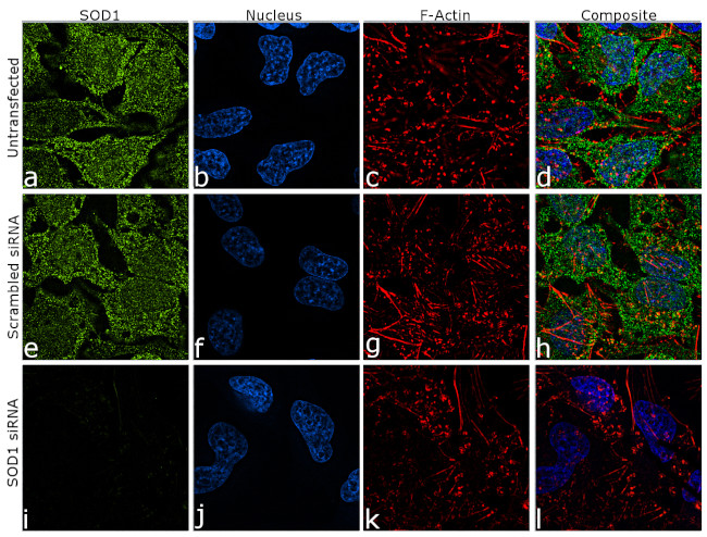 SOD1 Antibody