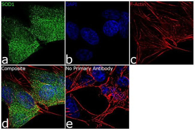 SOD1 Antibody in Immunocytochemistry (ICC/IF)