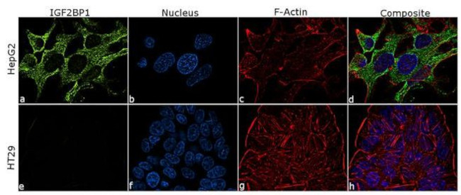 IGF2BP1 Antibody