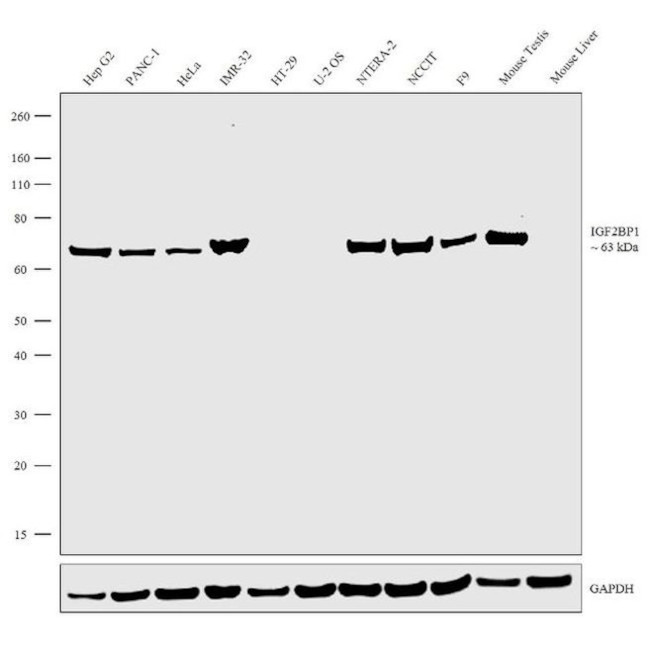 IGF2BP1 Antibody