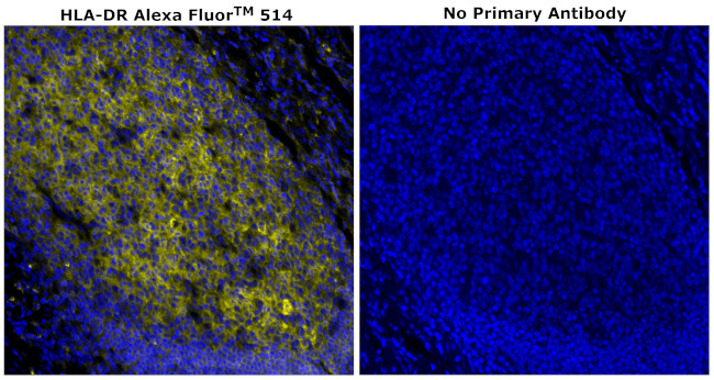 HLA-DR Antibody in Immunohistochemistry (Paraffin) (IHC (P))