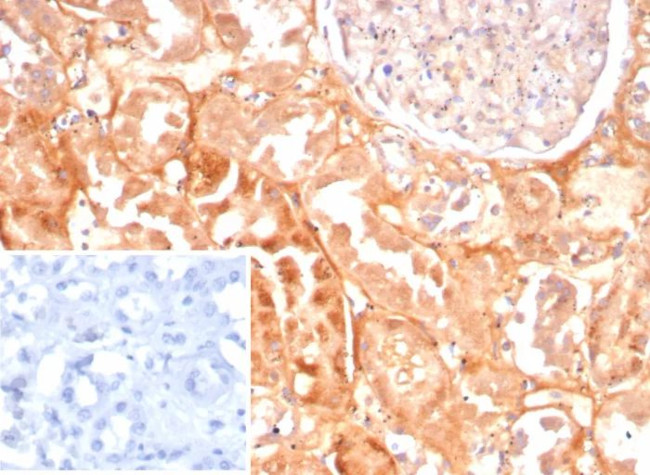 CASP7/Caspase-7 Antibody in Immunohistochemistry (Paraffin) (IHC (P))