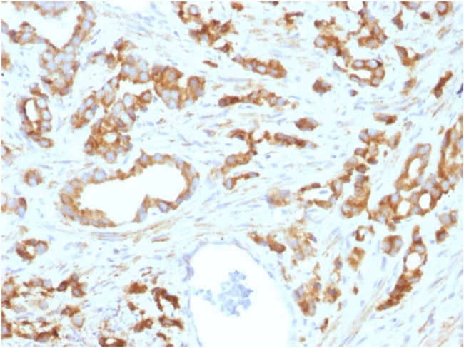 Aurora B Antibody in Immunohistochemistry (Paraffin) (IHC (P))