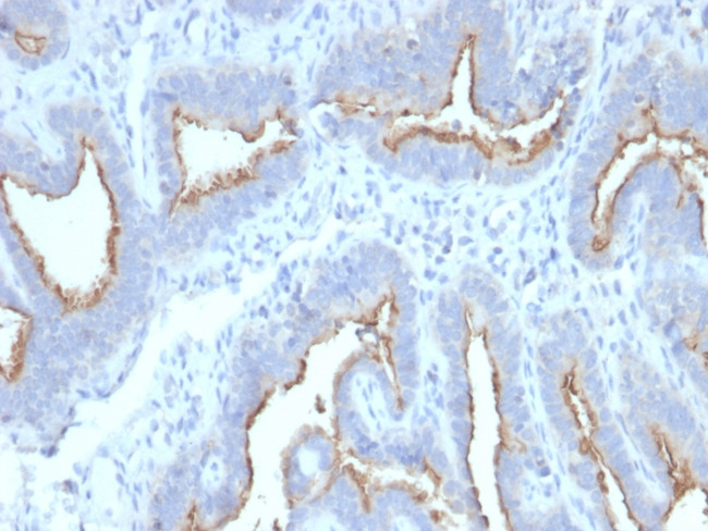 ATG5 Antibody in Immunohistochemistry (Paraffin) (IHC (P))