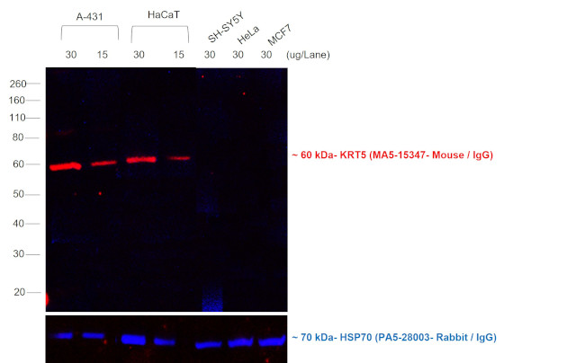 Mouse IgG (H+L) Cross-Adsorbed Secondary Antibody in Western Blot (WB)