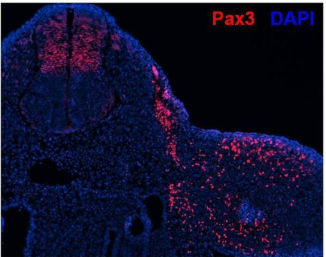 Rabbit IgG (H+L) Cross-Adsorbed Secondary Antibody in Immunohistochemistry (Frozen) (IHC (F))