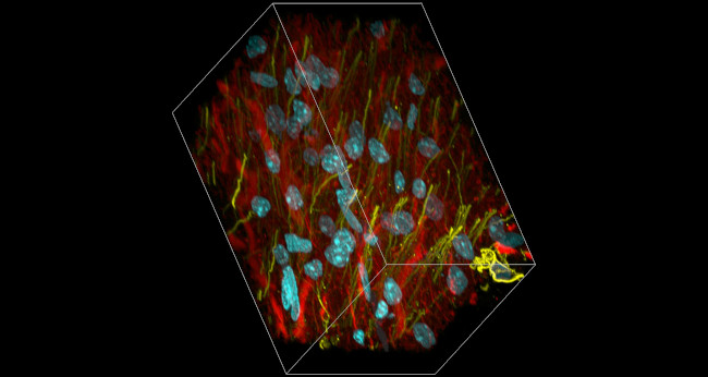 Mouse IgG (H+L) Highly Cross-Adsorbed Secondary Antibody in Immunohistochemistry (Frozen) (IHC (F))