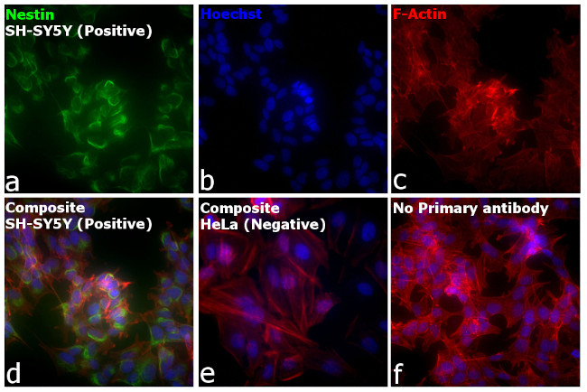 Mouse IgG (H+L) Cross-Adsorbed Secondary Antibody in Immunocytochemistry (ICC/IF)