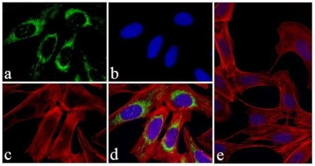 Mouse IgG (H+L) Cross-Adsorbed Secondary Antibody in Immunocytochemistry (ICC/IF)