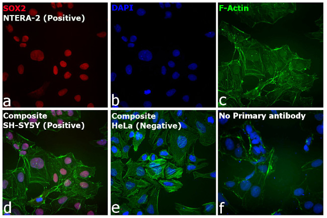 Rat IgG (H+L) Cross-Adsorbed Secondary Antibody in Immunocytochemistry (ICC/IF)