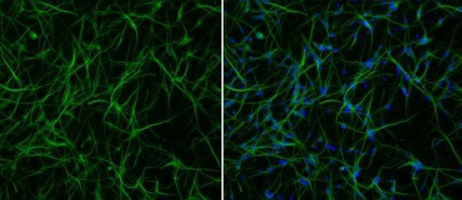 Rabbit IgG (H+L) Highly Cross-Adsorbed Secondary Antibody in Immunocytochemistry (ICC/IF)