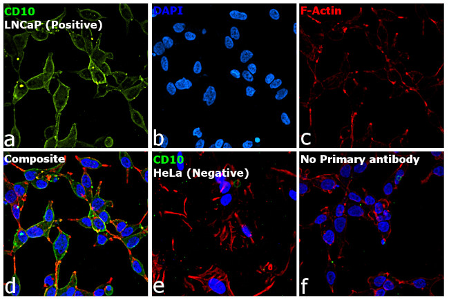 Goat IgG (H+L) Cross-Adsorbed Secondary Antibody in Immunocytochemistry (ICC/IF)