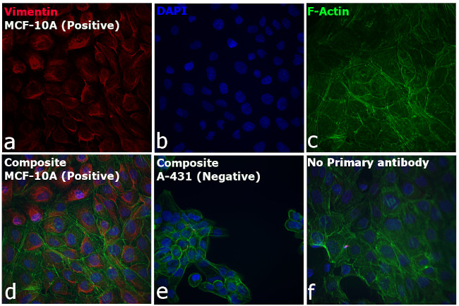 Rabbit IgG (H+L) Cross-Adsorbed Secondary Antibody in Immunocytochemistry (ICC/IF)