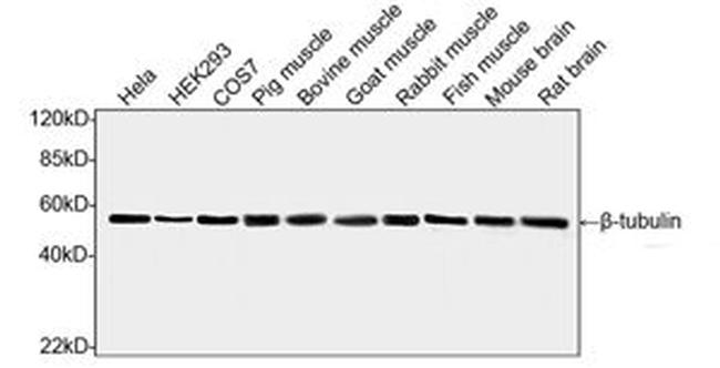 beta-tubulin Antibody in Western Blot (WB)